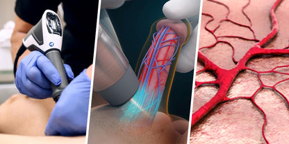 ED & PD Single treatment session , EMTT, ESWT, Infrared Light with Carboxy Co2