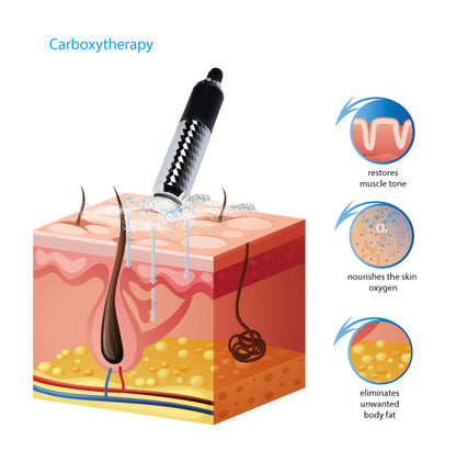 Hair restoration with  Advanced Carboxy CO₂ T